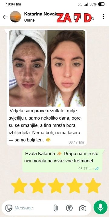 10-min