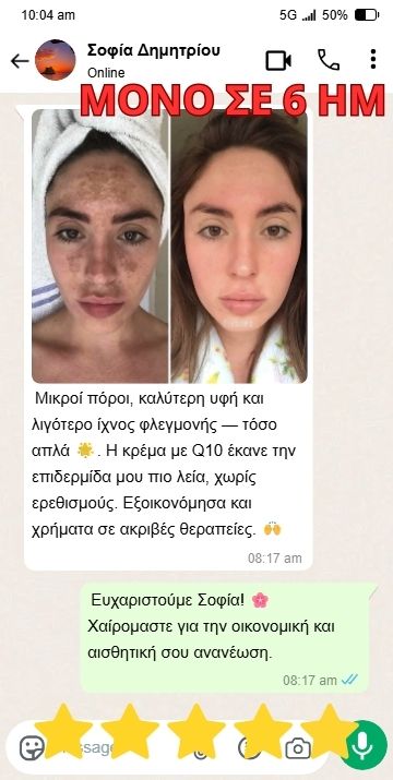15-min