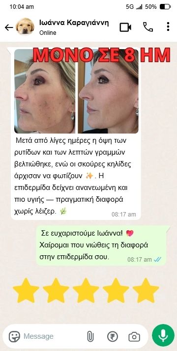 17-min