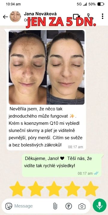 20-min