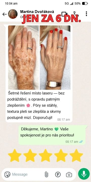 21-min